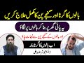 Ganjapan ka ilaj  baalbal girne ka ilaj  hair fall solution at home in urduhindi dr sharafat ali