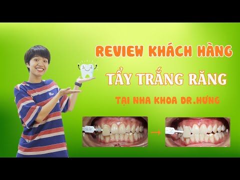 Tẩy trắng răng