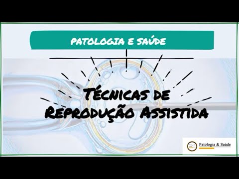 Vídeo: O que é inseminação intratubária?