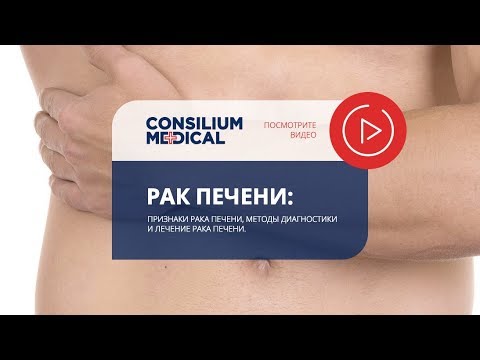 Признаки рака печени, методы диагностики и лечение рака печени