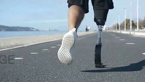 CDT Online Conference 2021: The Future of Prosthetics and Orthotics Promo Video