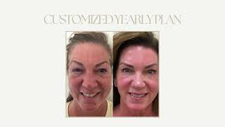 SKINRICHED AUGUST SLIDESHOW