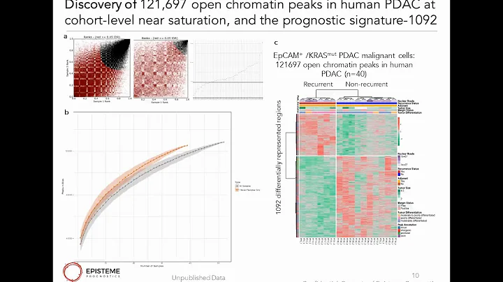Guiding pancreatic cancer therapy by individualized epigenetics