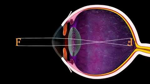 The Eye and Focus - 3D Medical Animation || ABP ©