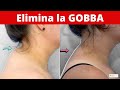 Cura la gobba in 3 minuti al giorno!