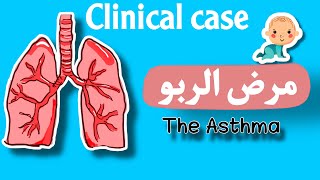 كيف تتعامل مع مريض الربو بالتفصيل /Clinical case