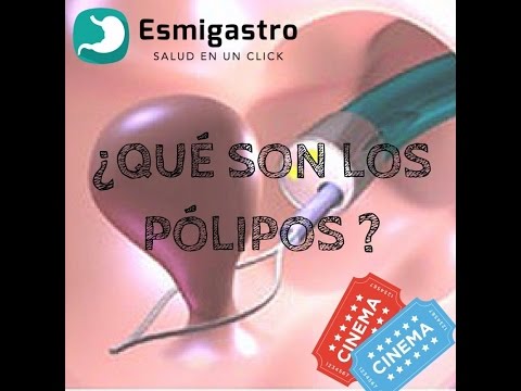 Vídeo: Pólipo Adenomatoso: Síntomas, Tratamiento, Fotos, Formas, Diagnóstico