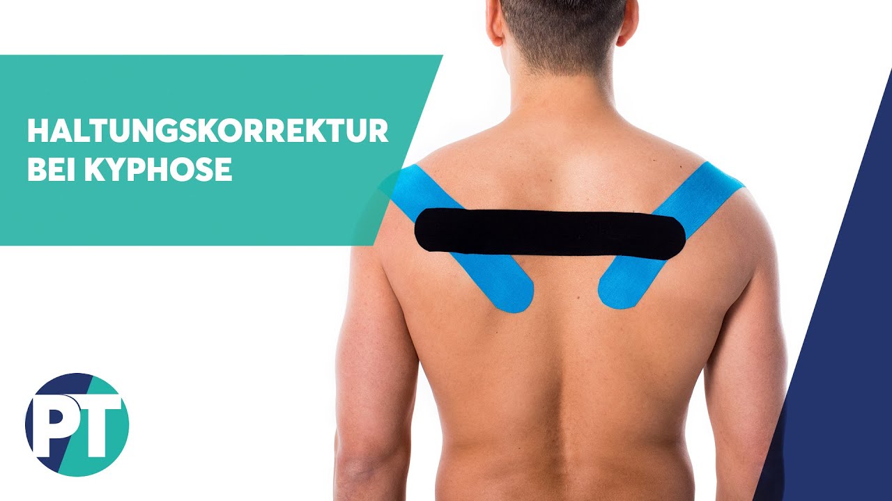 Haltungskorrektur bei Kyphose | Medical Taping | PhysioTape
