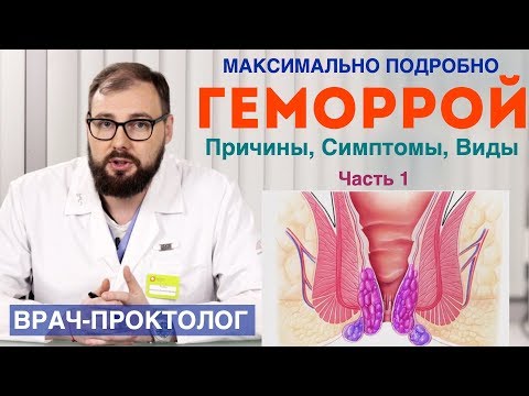 Геморрой - причины, симптомы, стадии и виды геморроя.