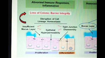 GCC agonists for ulcerative colitis - Video abstract: 32252