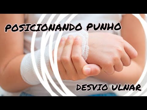 Vídeo: Desvio Ulnar (Deriva): O Que é Isso?