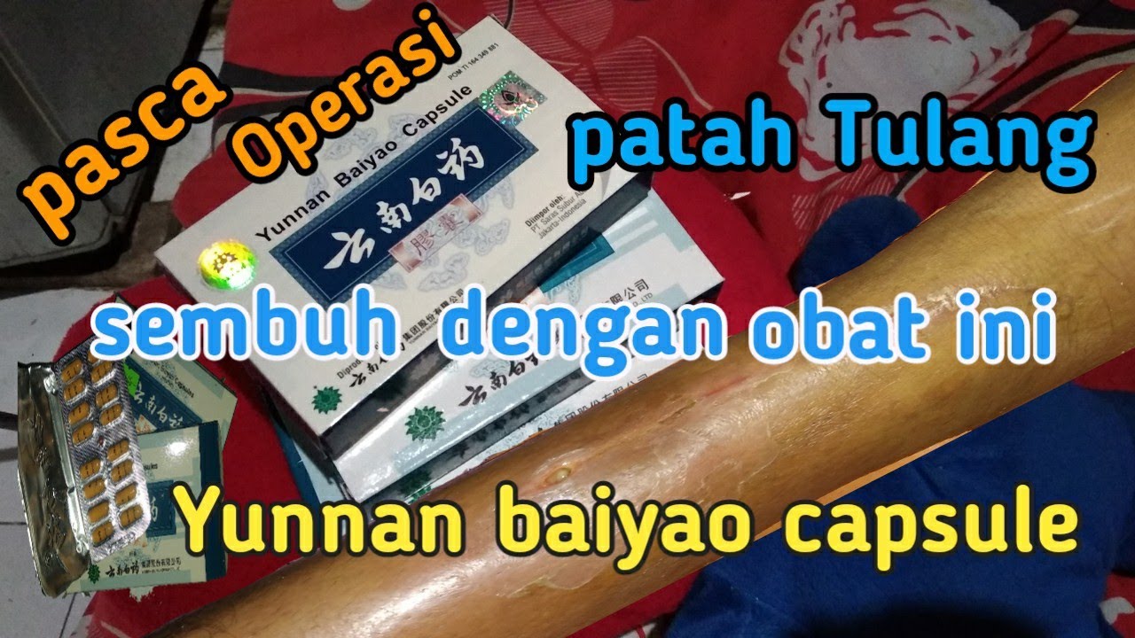 Yunnan Baiyao Capsule 1