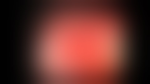 Colonoscopy of Amebic Colitis