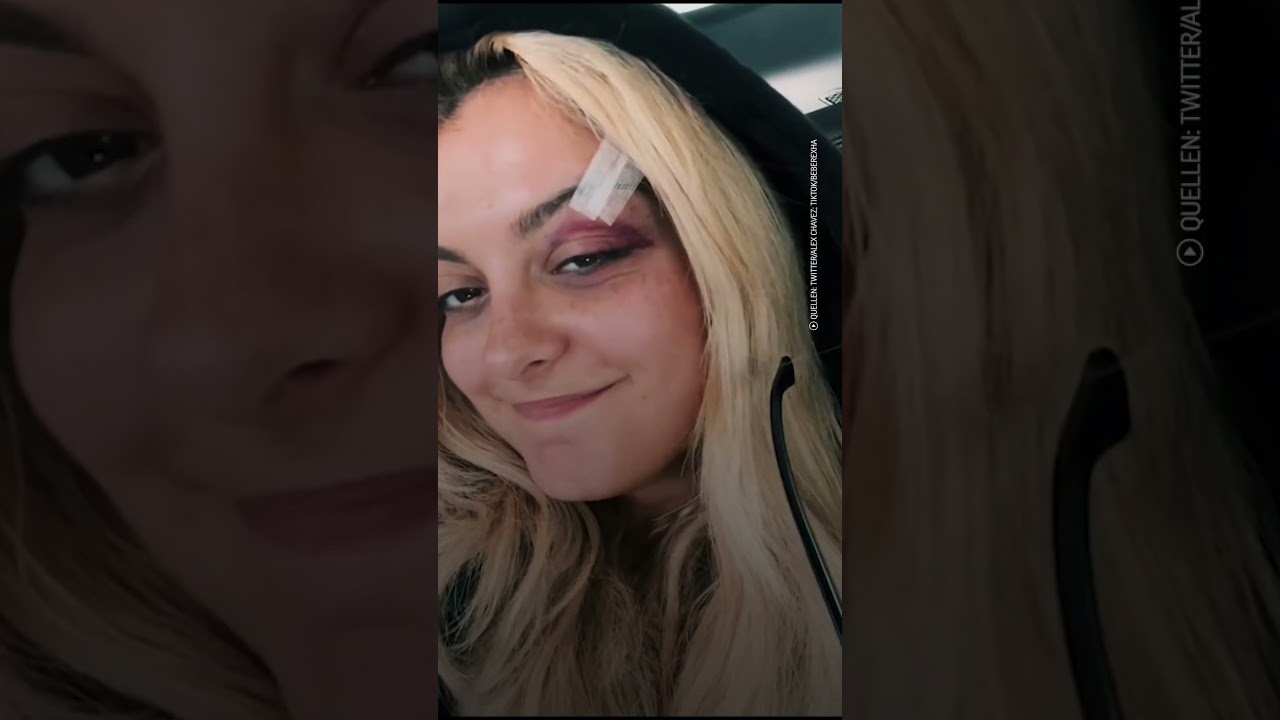 Zuschauer wirft Sängerin Bebe Rexha Handy an den Kopf | Blick