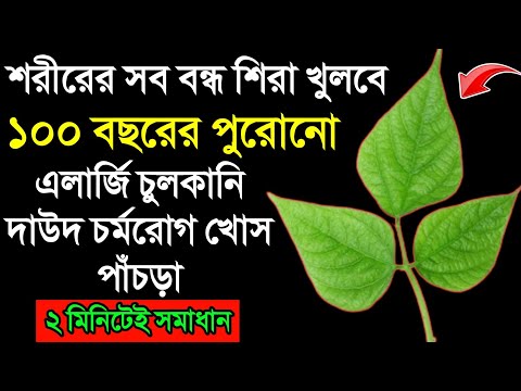 Silikon kokrak veb-kamerasi