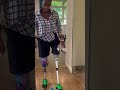 #fear of falling down🤦🏾#walking #prostheticleg #motivation #mobility #overcomingchallenges #happy