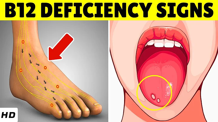11 Warning Signs of Vitamin B12 Deficiency You Should NEVER Ignore! (How To FIX IT)