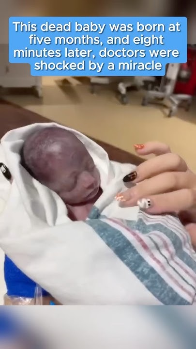 this-dead-baby-was-born-at-five-months-and-eight-minutes-later