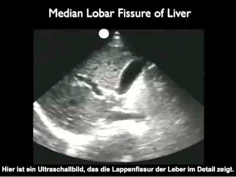 Anleitung: Gallenblasen-Ultraschalluntersuchung, Teil 1 – Einführung