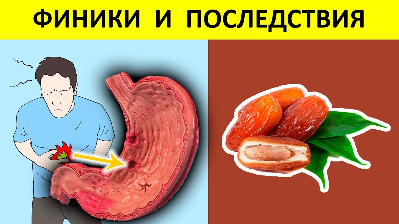 ФИНИКИ на голодный ЖЕЛУДОК могут привести к НЕОБРАТИМЫМ последствиям в теле