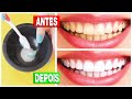 RECEITA CASEIRA: Como Clarear os DENTES com Bicarbonato