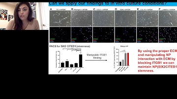 Extracellular Matrix in Renal Development and Cancer