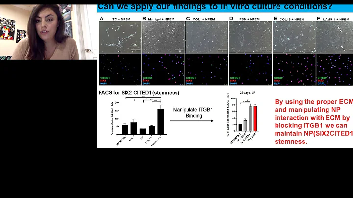 Extracellular Matrix in Renal Development and Cancer