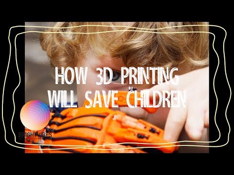 3D printing provides