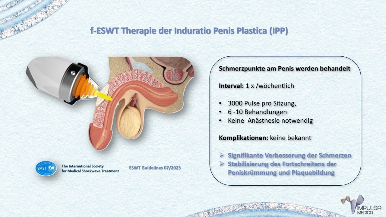 Stoßwellentherapie in der Urologie und Andrologie