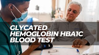 Glycated Hemoglobin HbA1c Blood Test in Diabetic Patients | A1c Level Diabetes Mellitus Type 2