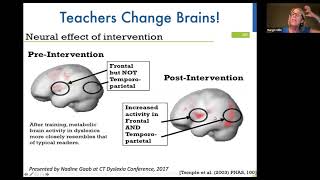 Why Bring the Science of Reading & Structured Literacy into the Classroom: A Talk w/ Margie Gillis