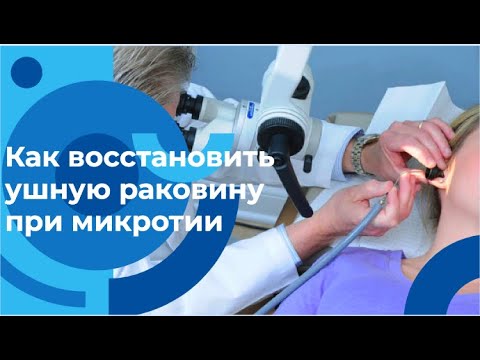 Что такое микротия и как восстановись ушную раковину: рассказывает Аднан Юнусов