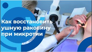 Что такое микротия и как восстановись ушную раковину: рассказывает Аднан Юнусов