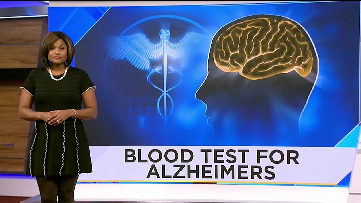 Study: Test could detect Alzheimer's years before symptoms begin