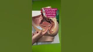 Some vaginas need extra support! #pelvicfloorhealth #prolapse
