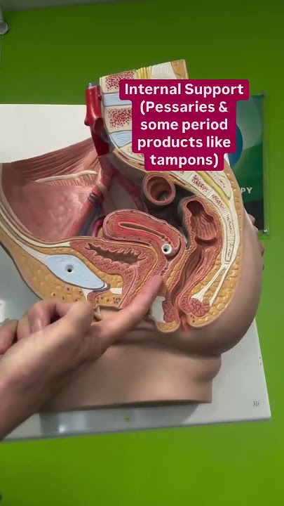 Beberapa vagina memerlukan dukungan ekstra! #kesehatandasarpanggul #prolaps
