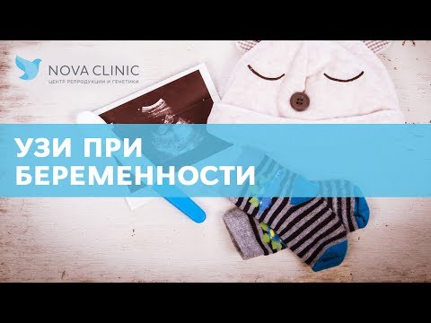 УЗИ при беременности