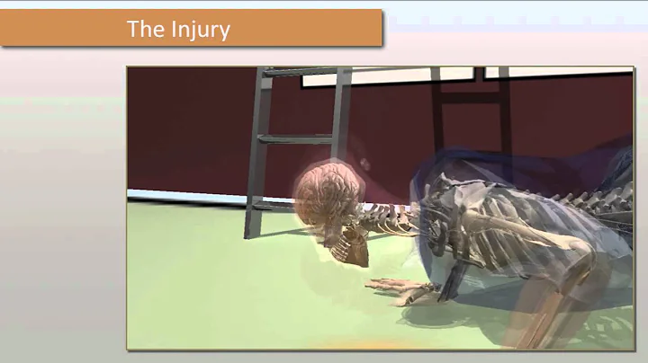 Traumatic Brain Injury Animation