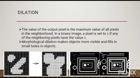 Boundary Detection in an image with MATLAB code
