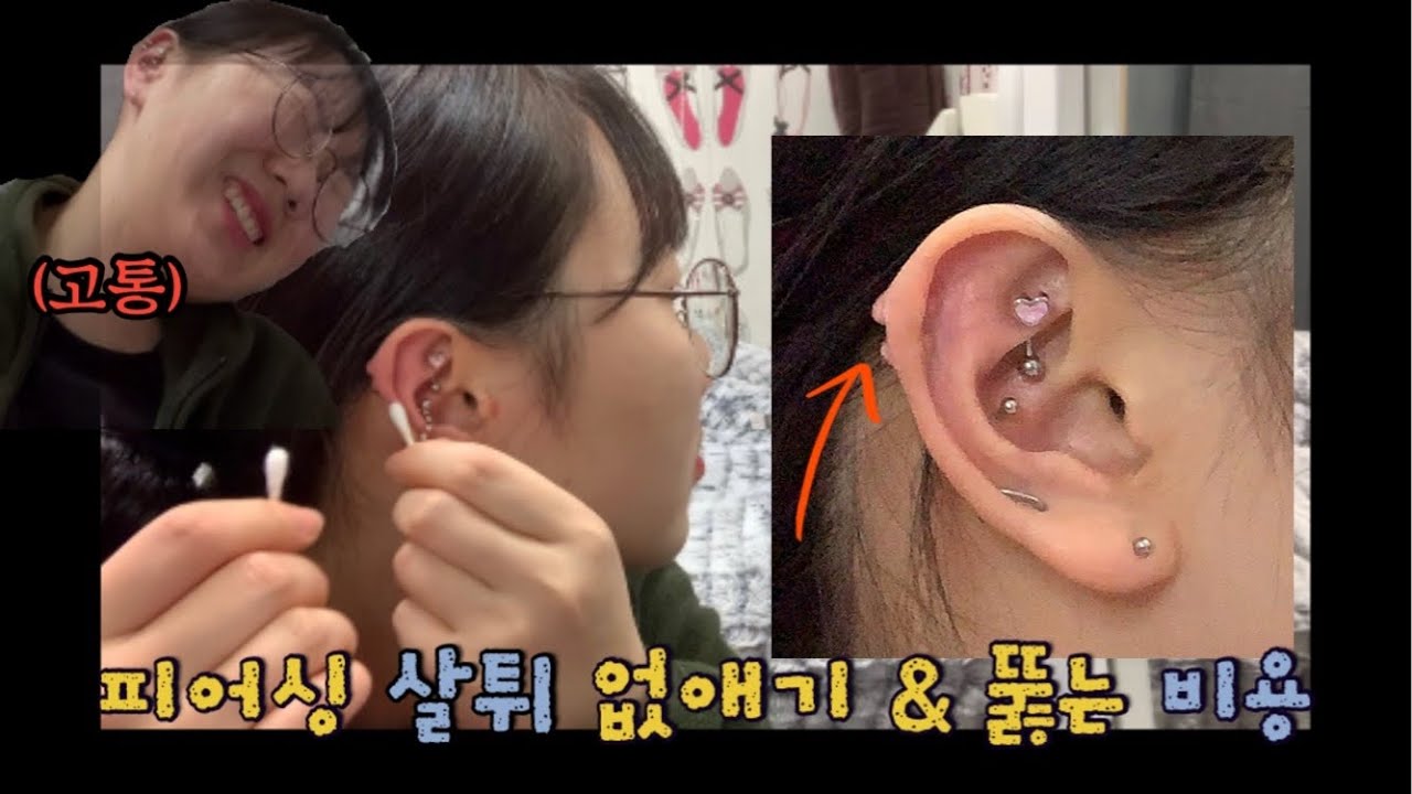 피어싱 관리 미루다가 결국 이렇게 됐다..