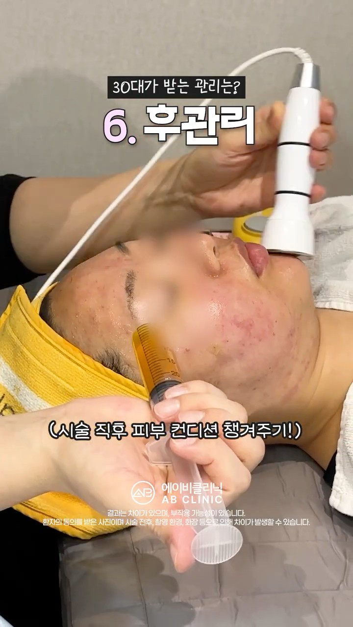 30대 관리 비법?!