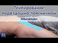 Тейпирование подвздошно-поясничной мышцы при болях в тазобедренном суставе