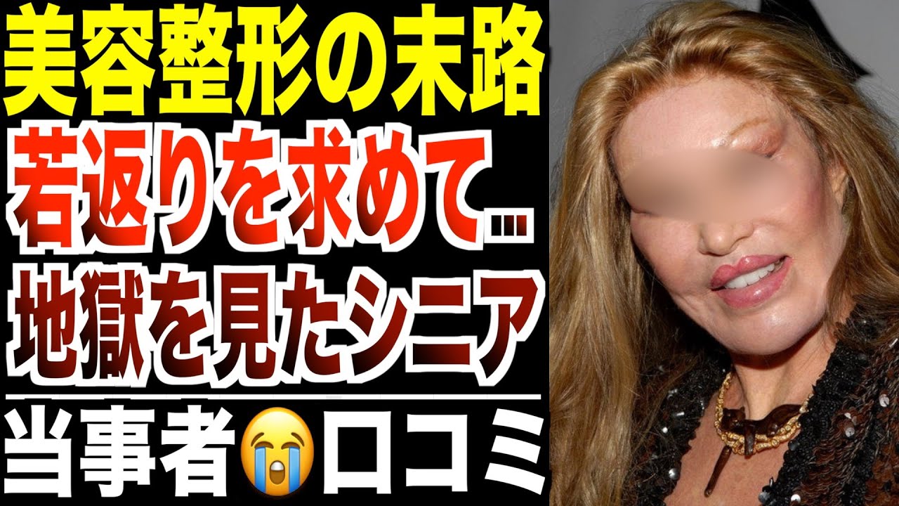 【美容整形の末路】若返りを求めて地獄を見たシニア！口コミ30選紹介します【パート4】