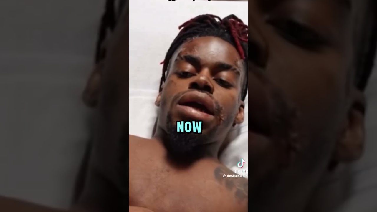  Ylnrich Tells His Story