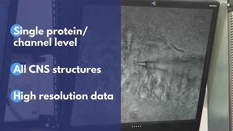 Neuroservice - Leader in patch clamp electrophysiology