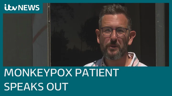 First monkeypox patient in UK to go public critici...