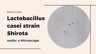 Lactobacillus casei strain Shirota (LcS) under a Mircroscope