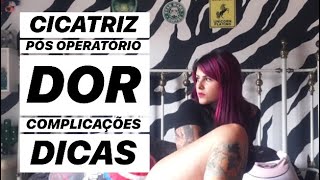 Nas dvt como coxas é um