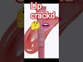 how lips put smooth in the winter some #lipbalm.