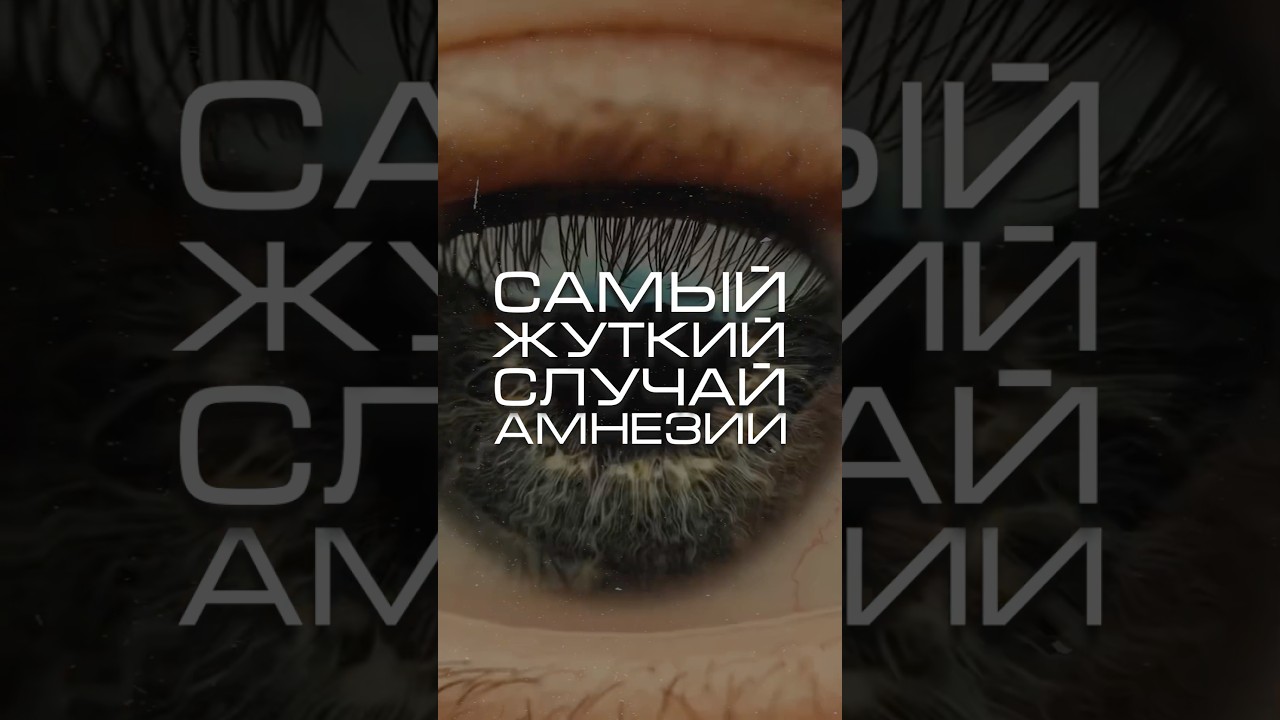 Самый жесткий случай амнезии в истории! 